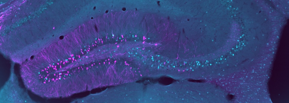dorsaler Hippocampus mit cFos und RAM